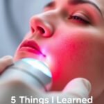 5 Things I Learned From Laser Skin Rejuvenation